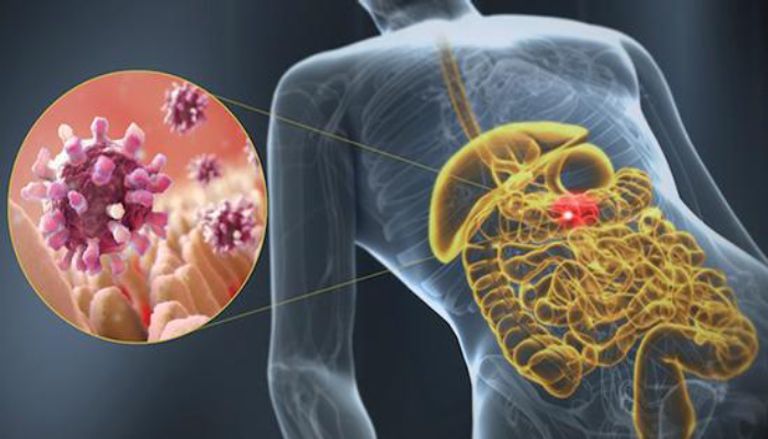 التهاب المعدة الفيروسي التهاب المعدة الفيروسي مرض إمام عاشور