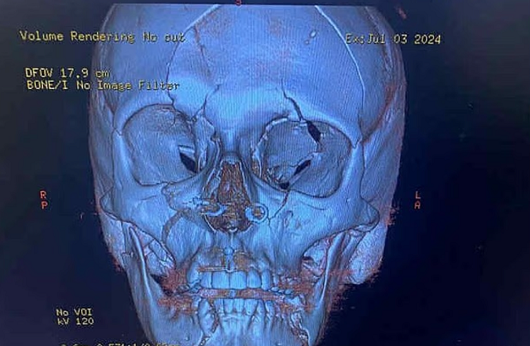 الأم سافانا وايت العائدة للحياة مع نجلها
