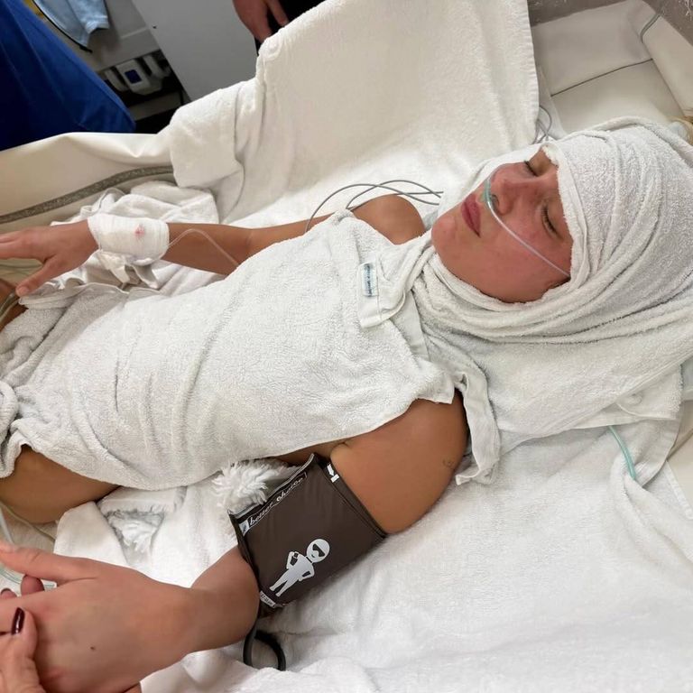 بيلا حديد تكافح داء لايم