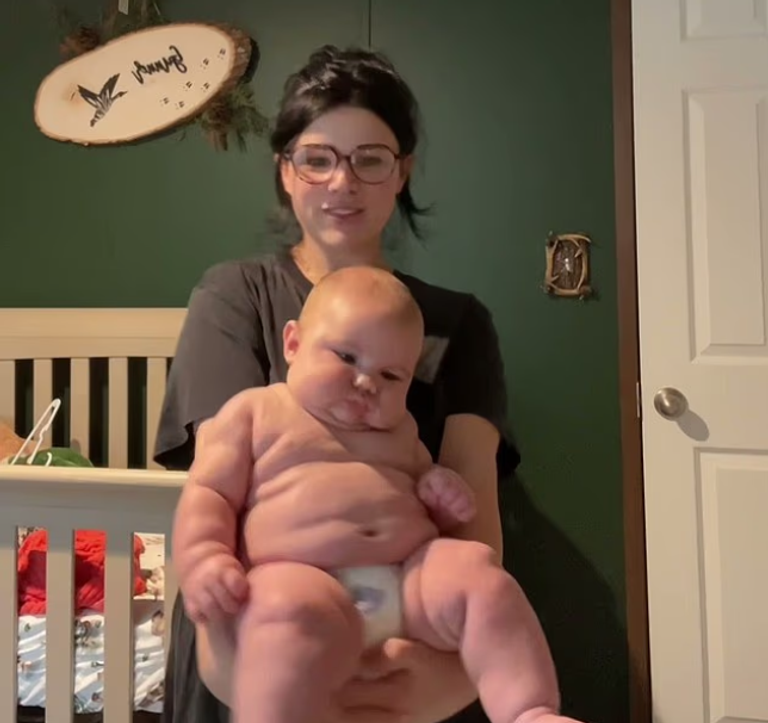 تزايد ملحوظ في ظاهرة ولادة أطفال بأحجام استثنائية