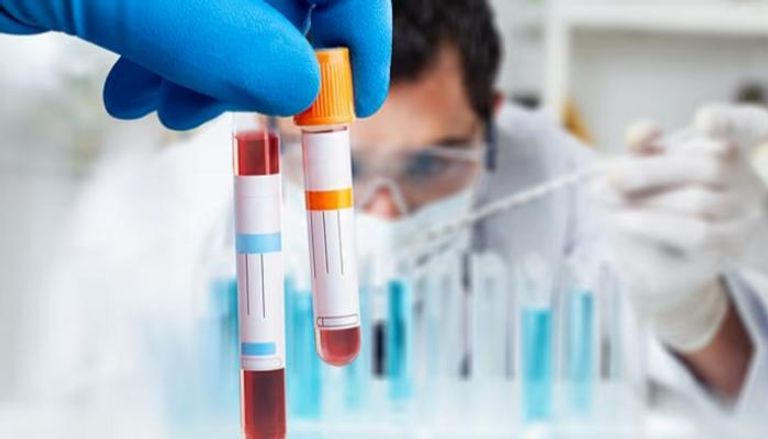 اختبار بسيط يتنبأ بخطر الكبد قبل ظهور الأعراض 