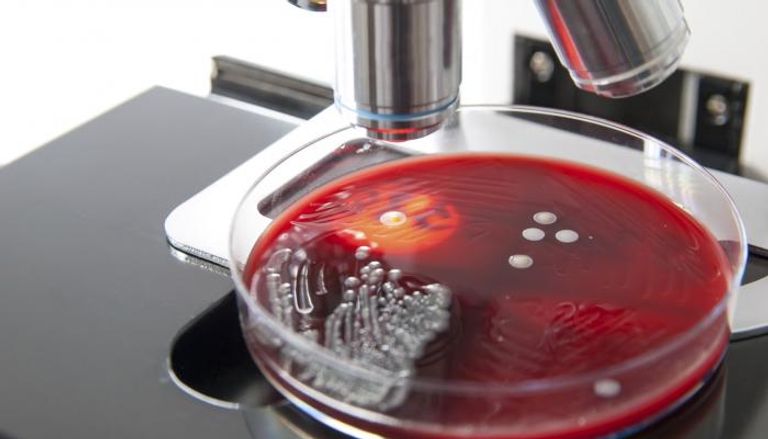 رصد بكتيريا خارقة تتحدى أقوى المضادات الحيوية