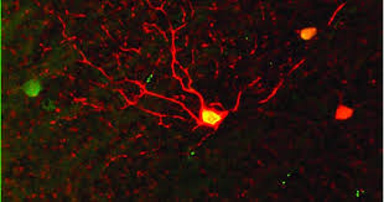 العلماء رصدوا حركة دقيقة للغاية في خلايا الرؤية الليلية للعين عند استشعار الضوء