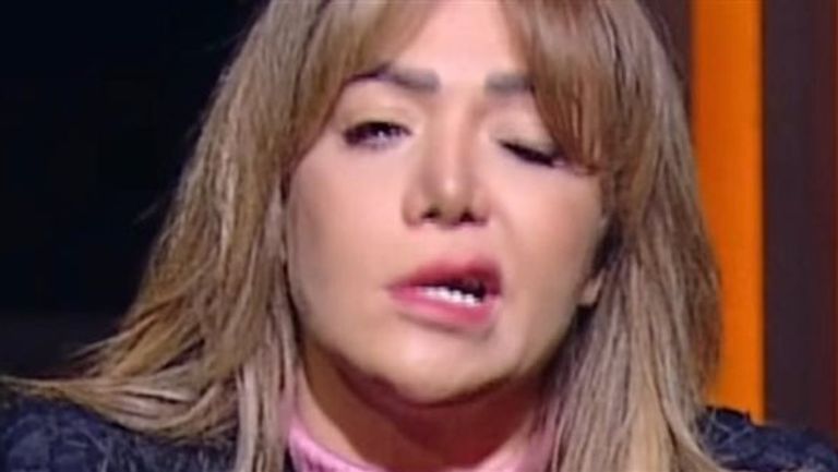 إصابة لقاء سويدان بالعصب السابع