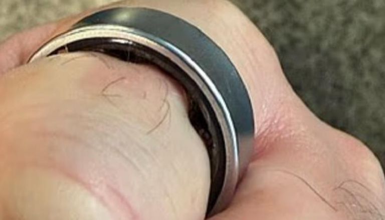 خاتم سامسونغ الذكي تسبب في تورم إصبع اليوتيوبر البريطاني دانيال روتار