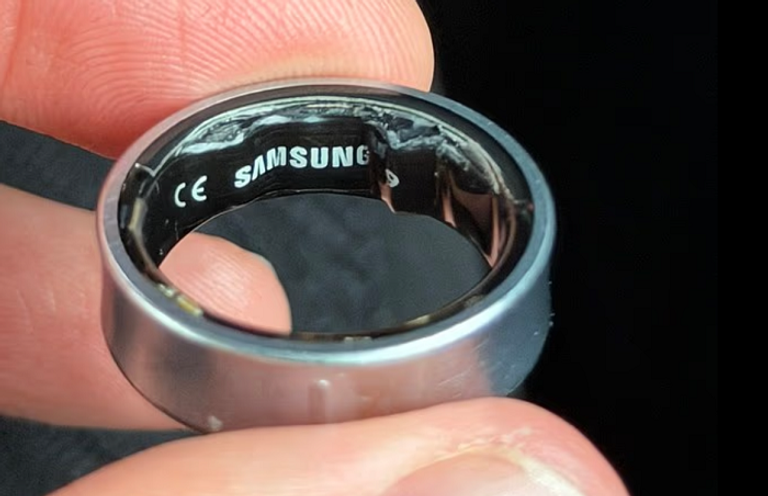 خاتم سامسونغ الذكي تسبب في تورم إصبع اليوتيوبر البريطاني دانيال روتار