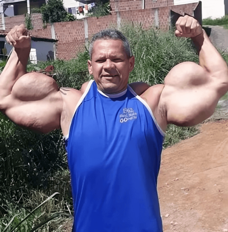  لاعب كمال الأجسام باباي البرازيلي