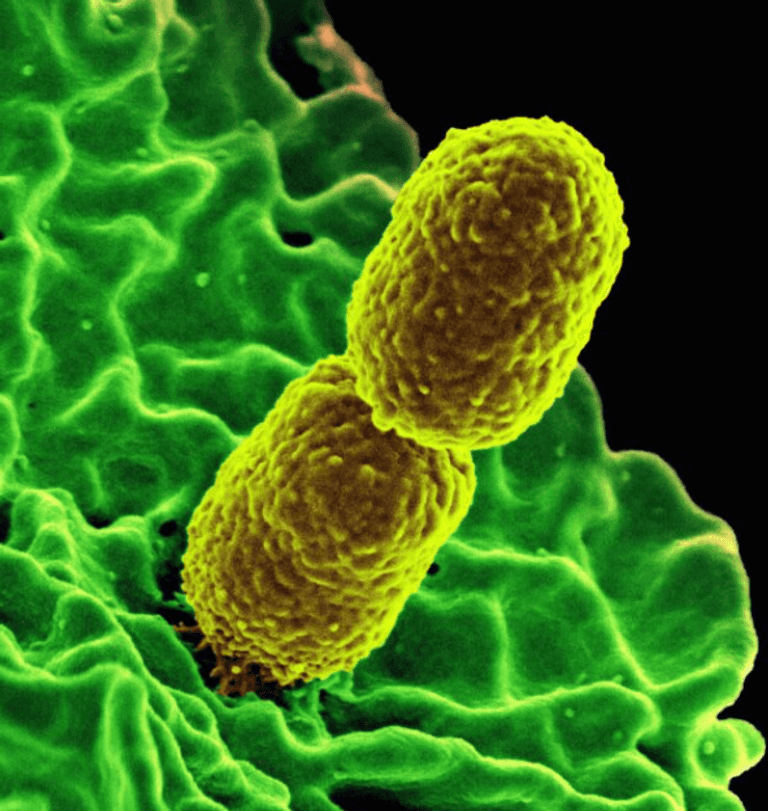 بكتيريا الأمعاء