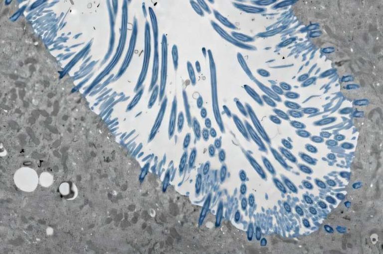 دفاعات أنسجة الأنف العامل الحاسم في الإصابة بالزكام 