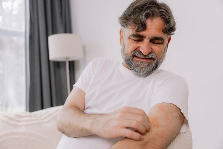 تحذير صحي عاجل من ارتفاع حاد في حالات الجرب ببريطانيا