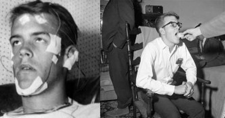 الدماغ يلجأ خلال فترات عدم النوم إلى ما يشبه «القيلولة الجزئية»