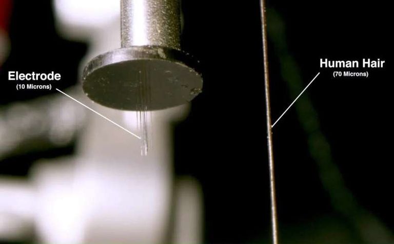  أقطاب كهربائية مطلية بالألماس قد تكون العلاج الذي يعيد القدرة على المشي