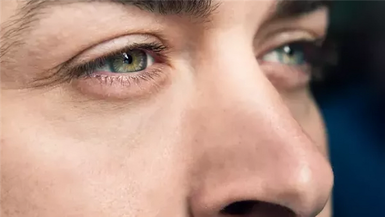 عمى الألوان - تعبيرية