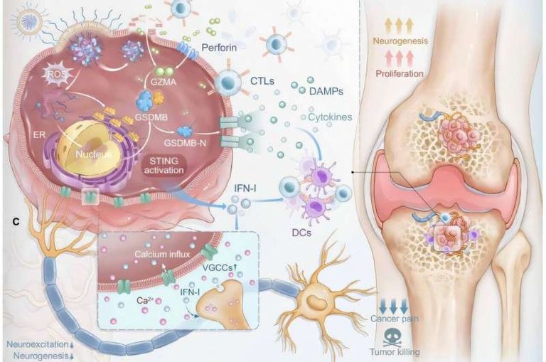 علاج نانوي ذكي يحسن دقة علاج سرطان العظام