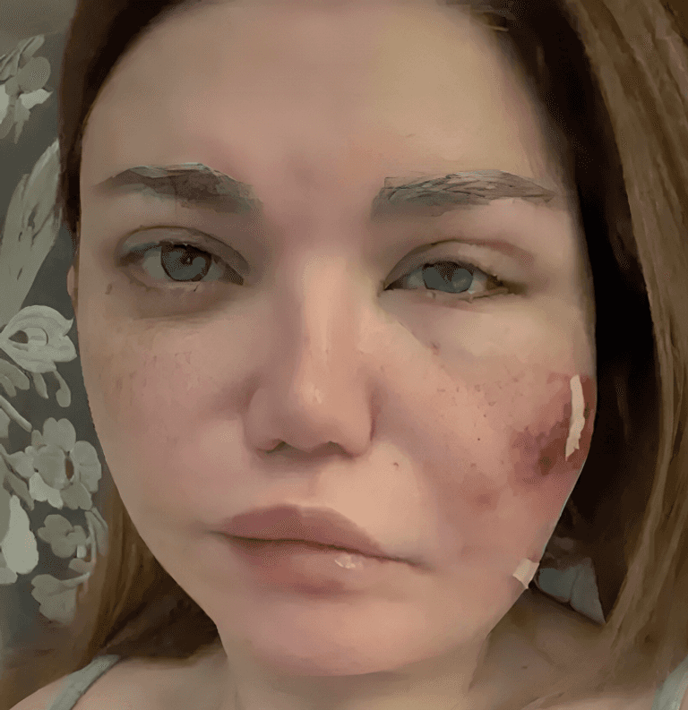 بعد جراحة دقيقة في الوجه.. ياسمين الخطيب تكشف تفاصيل مرضها - صورة 1