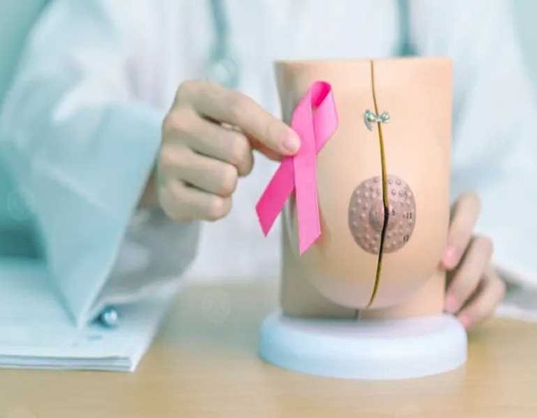 الكشف المبكر عن سرطان الثدي ينقذ آلاف النساء في فرنسا - صورة 1