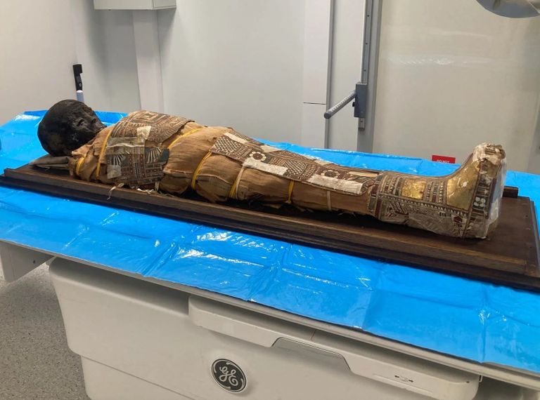 طفل مصري مُحنط منذ أكثر من ألفي عام.. الأشعة المقطعية تكشف قصته (خاص) - صورة 1