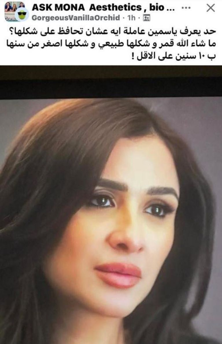 ياسمين عبدالعزيز تحسم شائعات عمليات التجميل برسالة مباشرة لجمهورها - صورة 1