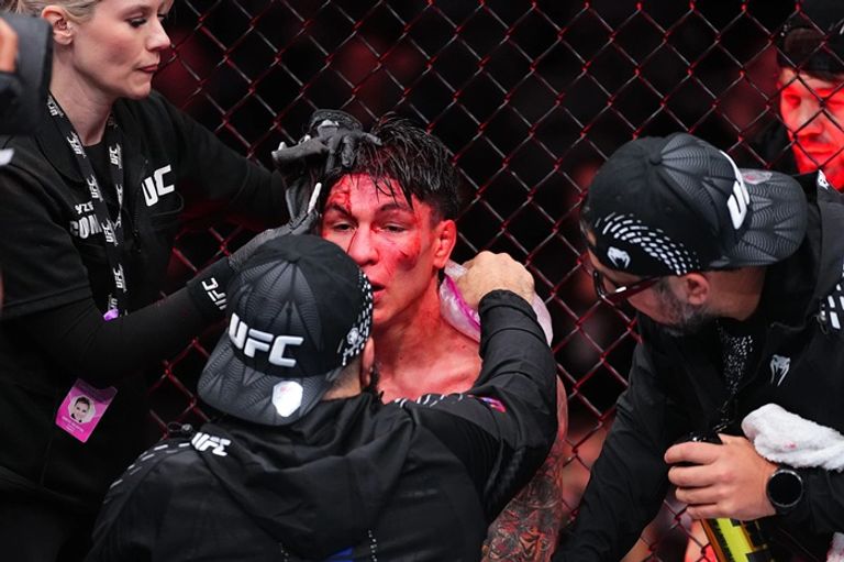 في مشاهد دامية بـ&laquo;UFC&raquo;.. نقل 3 مقاتلين للمستشفى - صورة 1