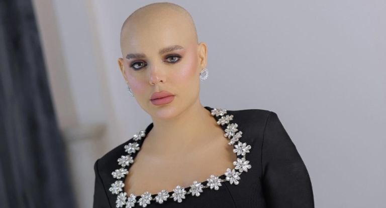 هبة السيسي تكشف عن سبب رفضها ارتداء باروكة بعد الإصابة بالسرطان - صورة 2