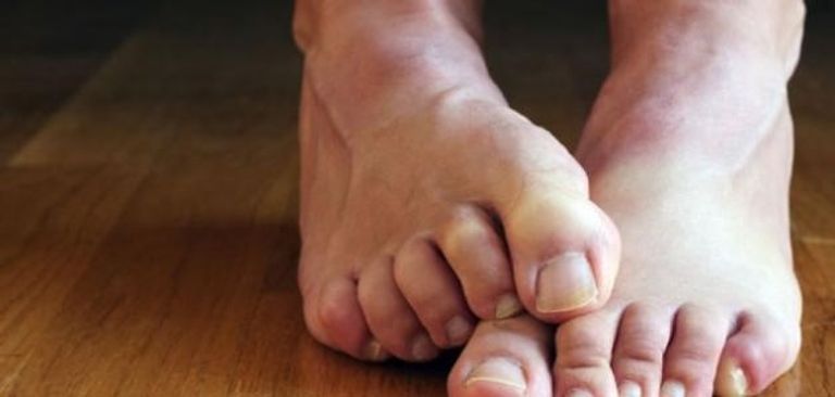 حكة القدمين قد تكشف أمراضا خطيرة - صورة 1