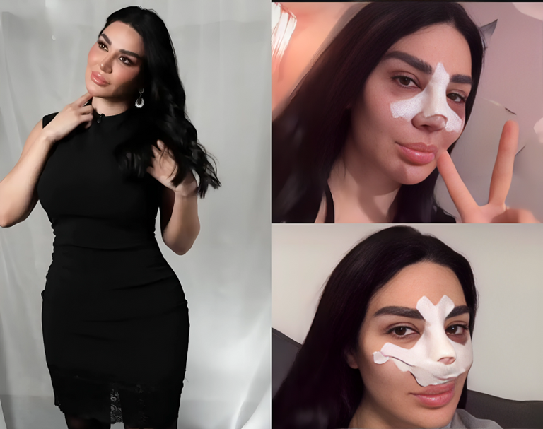 الفنانة سارة نخلة سارة نخلة تكشف تفاصيل جراحة الأنف وتوضح سببها الحقيقي - صورة 1