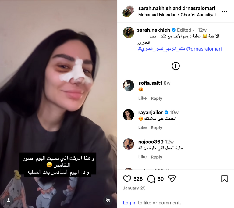 الفنانة سارة نخلة سارة نخلة تكشف تفاصيل جراحة الأنف وتوضح سببها الحقيقي - صورة 2
