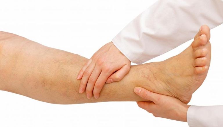 إصابات القدم في الحج 2026: دليل الوقاية وعلاج التسلخات والإجهاد العضلي - صورة 3