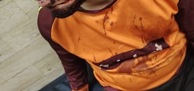 مصر.. القبض على &laquo;سايس&raquo; بتهمة تشويه وجه مندوب توصيل حدائق القبة بـ36 غرزة - صورة 2