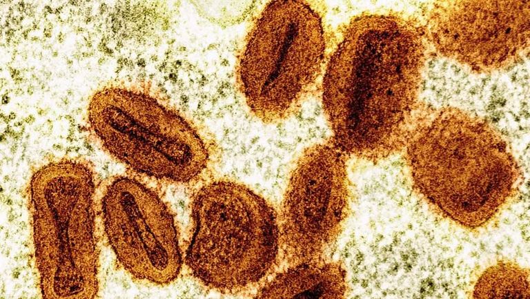فضيحة علماء الـ NIH.. محاولة تهريب فيروسات خطيرة لأمريكا - صورة 2