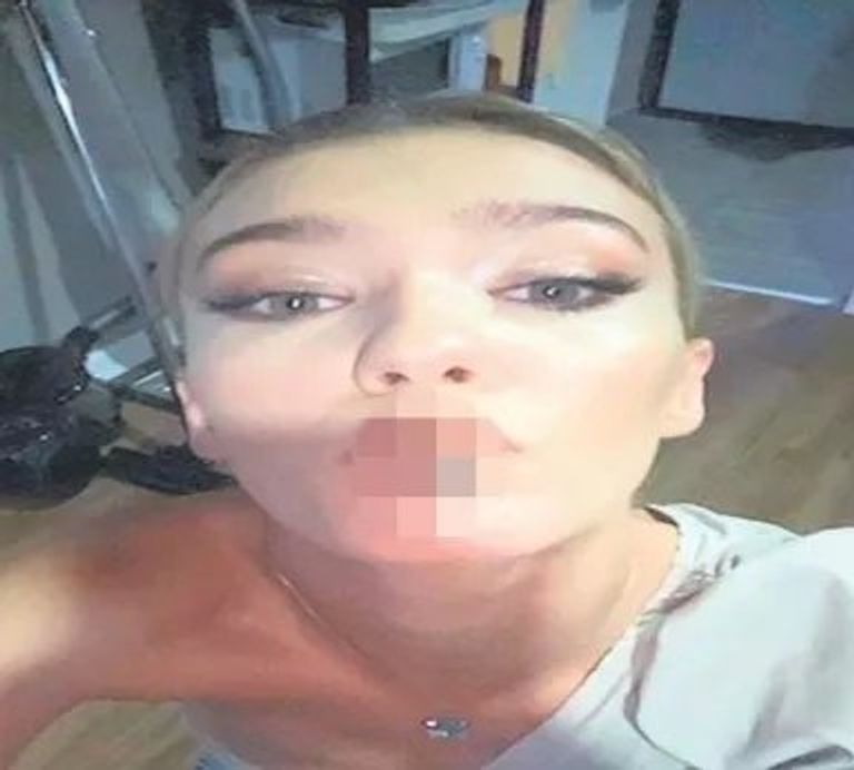 قضية مخدرات المشاهير.. الفنانة ميليسا دونجل تدخل ضمن التحقيقات التركية - صورة 2