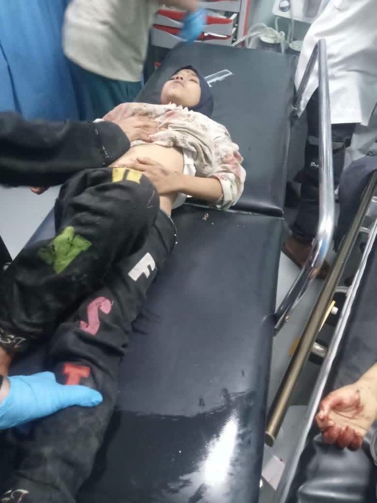 فاجعة في الضالع.. لغم حوثي يحصد أرواح 4 أطفال ويصيب 13 آخرين - صورة 1
