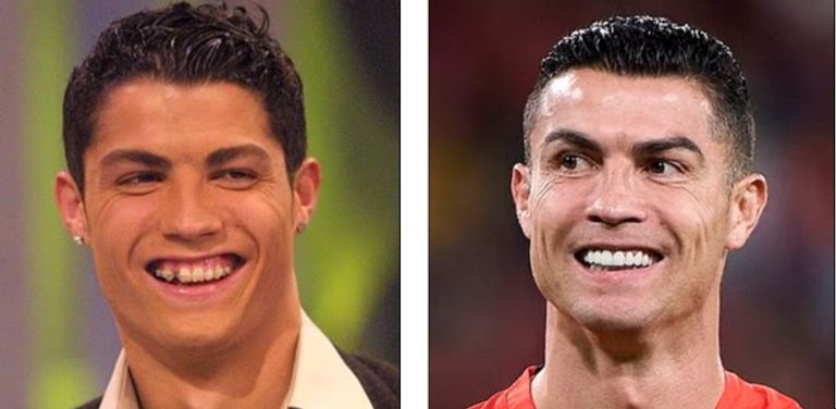 بينهم محمد صلاح.. خبراء يكشفون أسرار  خضوع نجوم المونديال لعمليات تجميل - صورة 2