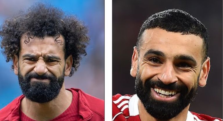 بينهم محمد صلاح.. خبراء يكشفون أسرار  خضوع نجوم المونديال لعمليات تجميل - صورة 4