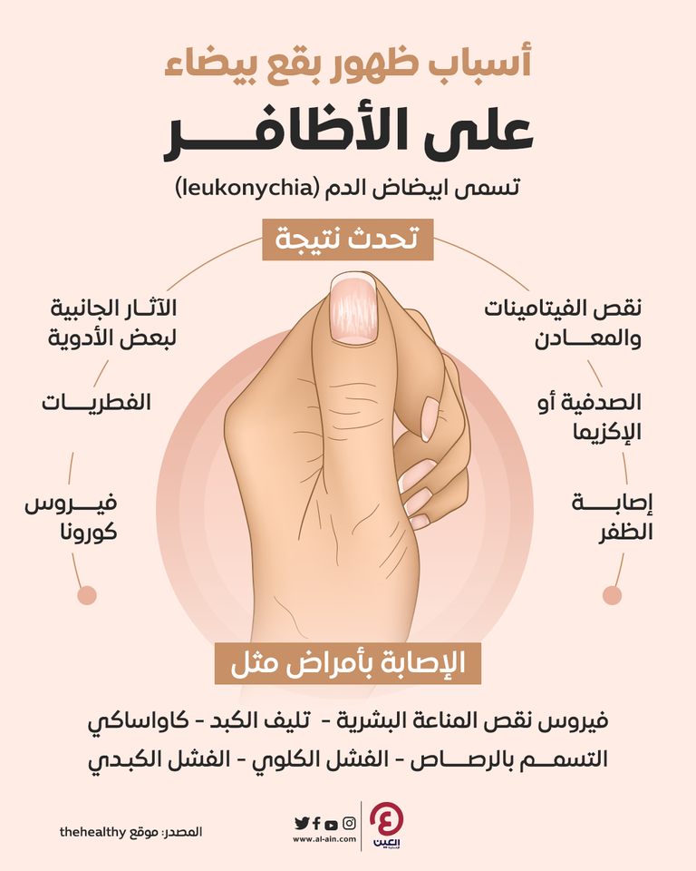 عادة يومية تترك أظافر قدميك صفراء ومتشققة.. طبيبة تكشف السبب والحل - صورة 2