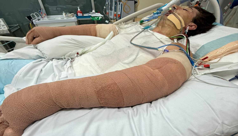 بسبب مكنسة ذكية.. شاب أسترالي يواجه الموت وسط أنقاض منزله المتفحم - صورة 2