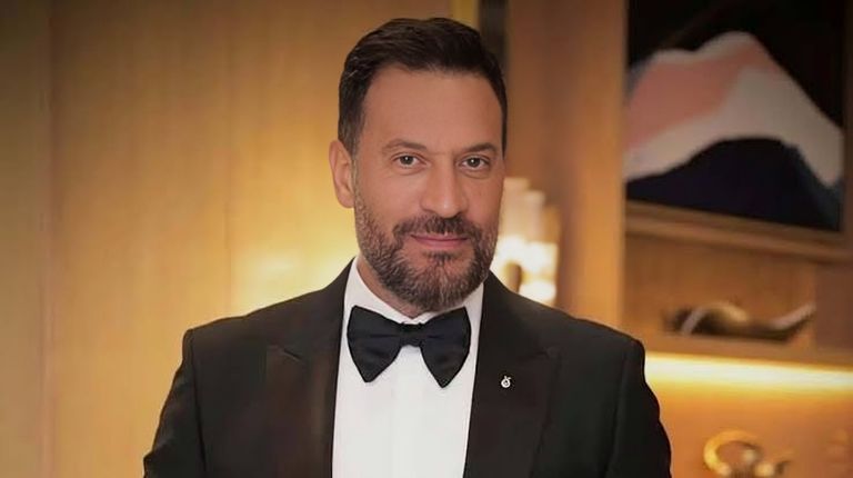 الفنان ماجد المصري ماجد المصري يكشف تفاصيل حالته الصحية بعد إصابة مفاجئة في العين - صورة 1
