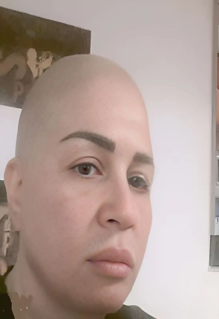 شوق الهادي وإلهام شاهين في قائمة نجمات تخلين عن الشعر بالكامل - صورة 6