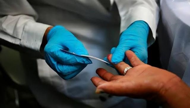 إنتاج خلايا الدم لدى البشر يختلف عن الفئران