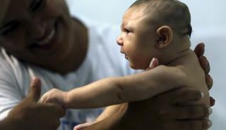 البرازيل تعتبر معظم حالات إصابة المواليد بصغر حجم الرأس مرتبطة بعدوى زيكا الفيروسية 