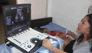 ظهور تشوهات على أجنة في بنما متأثرة بفيروس زيكا