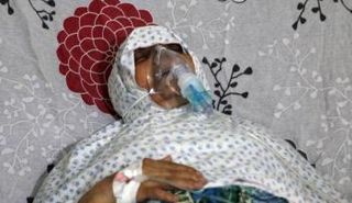 امرأة تخضع للعلاج بمستشفى في حلب