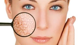  ارتفاع درجات الحرارة وانخفاض شرب الماء يؤديان إلى جفاف البشرة 