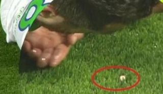 لاعب الوسط البرتغالي فارينها يتعرض لإصابة يفقد خلالها إحدى أسنانه