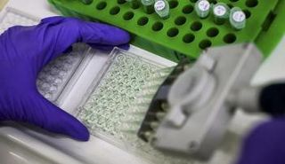 عالم يعد عينات من البروتين للتحليل داخل مختبر في بريطانيا