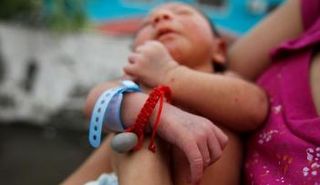 مولود في هندوراس مصاب بالميكروسيفالي أو صغر حجم الرأس للمواليد الذي يسببه فيروس زيكا