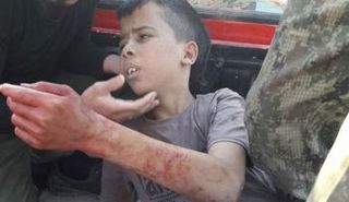 الطفل الفلسطيني عبد الله عيسى