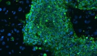 صورة مجهرية من أرشيف رويترز توضح خلايا جذعية من الحبل السري