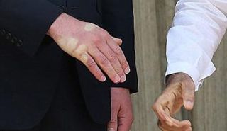 مصافحة رئيس الوزراء الهندي للأمير ويليام تركت أثارها على يد الأمير