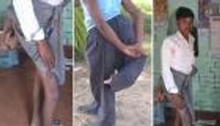 رجل "الأقدام الأربعة" ينعزل هربًا من لقب "الشيطان"